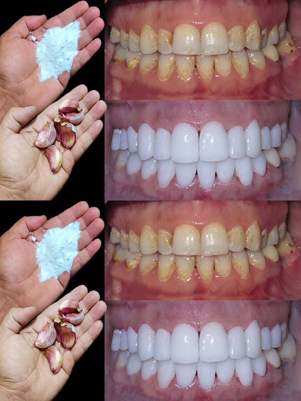 How to whiten teeth in 2 minutes?