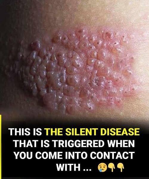 What few people know about this silent disease that can appear without warning