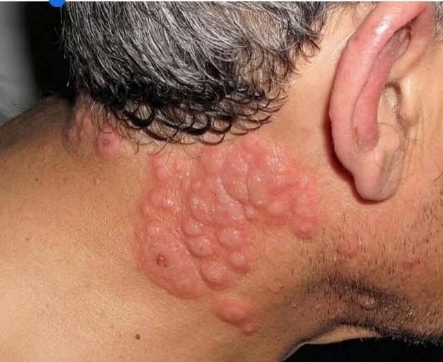 Here are the consequences of sleeping with… See more